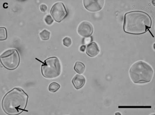 <p>Do the following starch granules have a centric or eccentric hilum?</p>