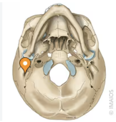 <p>bone/structure highlighted</p>