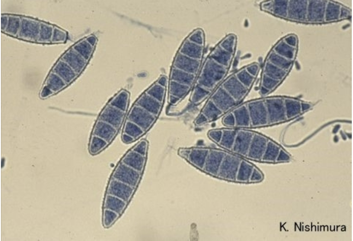 <p>-Scalp and skin infections, common in animals</p><p>-Oval, rough walled macroconidia with <6 cells/compartments</p>