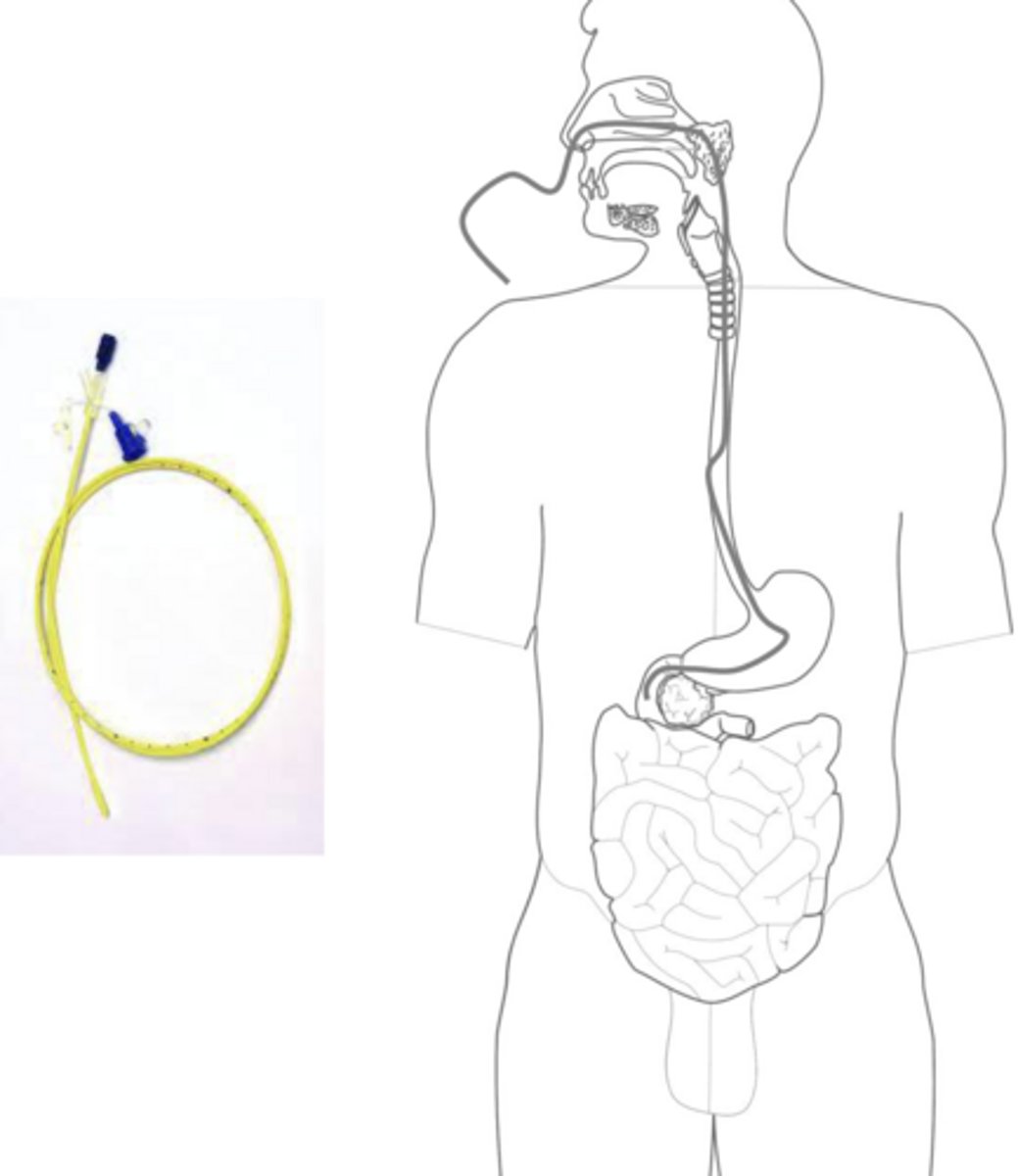 <p>nose -> esophagus -> stomach -> duodenum</p><p>inserted through nose, mouth, or surgical opening</p>