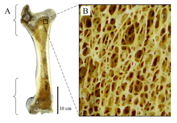 Q: ……. Is developed where greatest stress occurs.
A. Compact bone
B. Cortex
C. Spongy bone
D. Periosteum