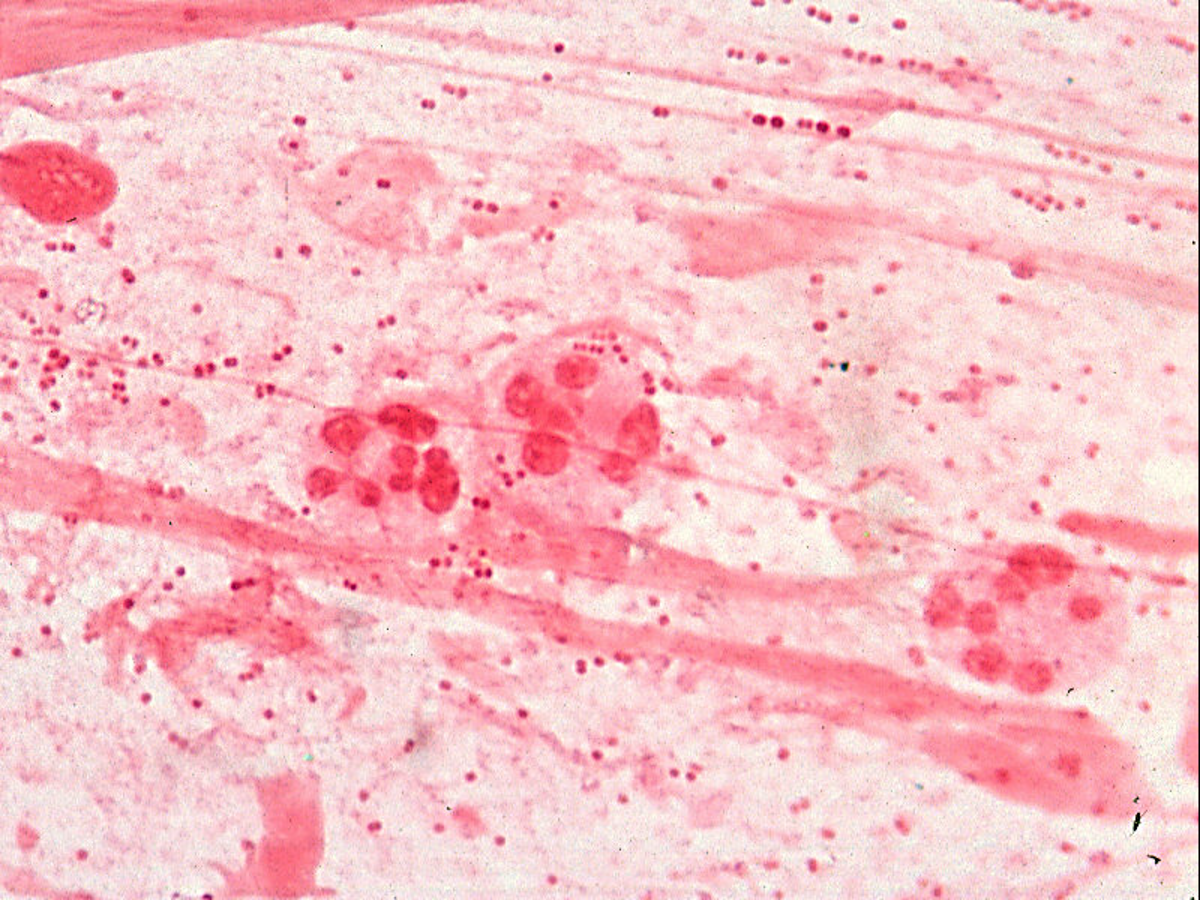 term image