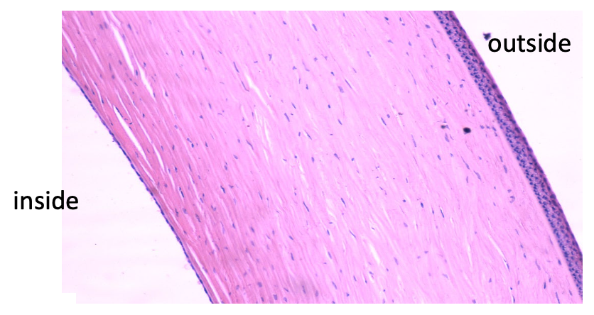 <p>Transparent tissue that bends (refracts) light into the eye</p>