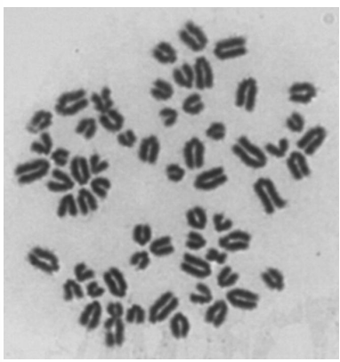 <p>Wskaż chromosomy, w których doszło do pęknięć/złamań chromatynowych.</p>