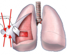 <p>double-layered membrane surrounding each lung</p>