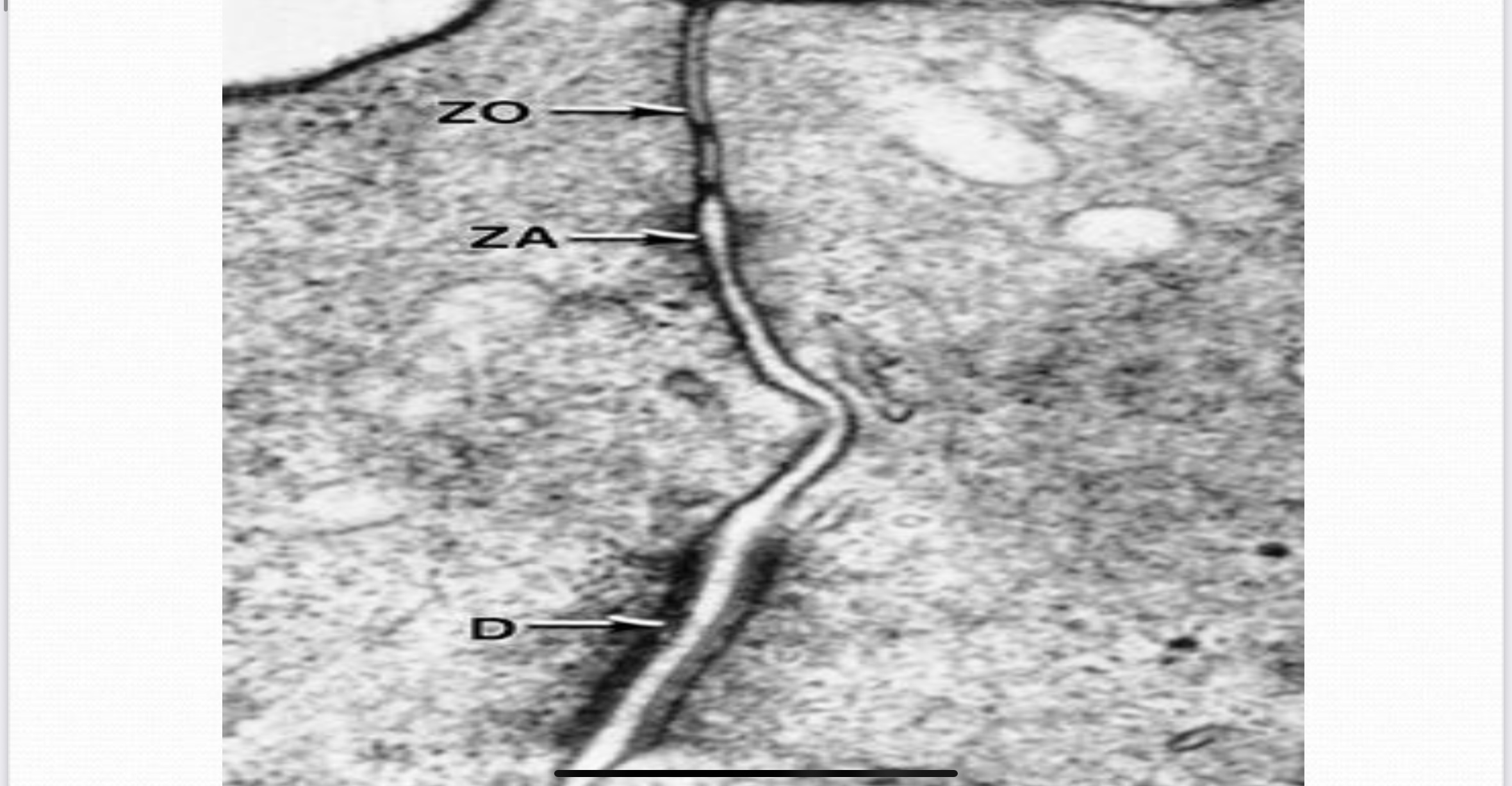 <p>Zonula occludens</p>