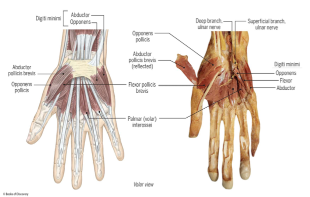 <p><em>Abductor pollicis brevis</em></p><p style="text-align: left;"><em>Flexor pollicis brevis</em></p><p style="text-align: left;"><em>Opponens pollicis</em></p><p style="text-align: left;"></p><p style="text-align: left;"><em>(open and close palm)</em></p>