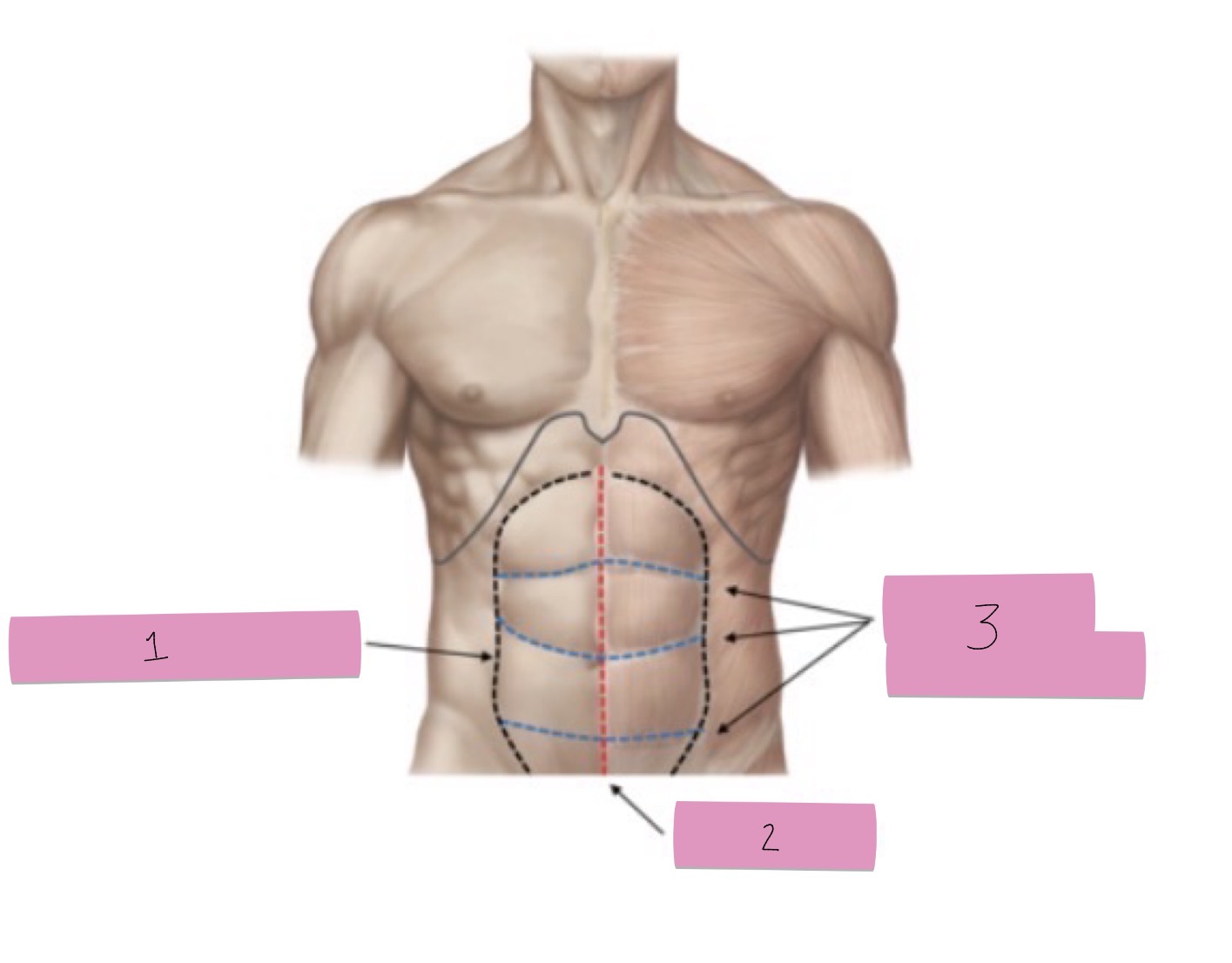 <p>What is 3 pointing to?</p>