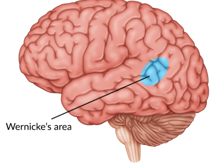 <p>Wernicke’s area</p>