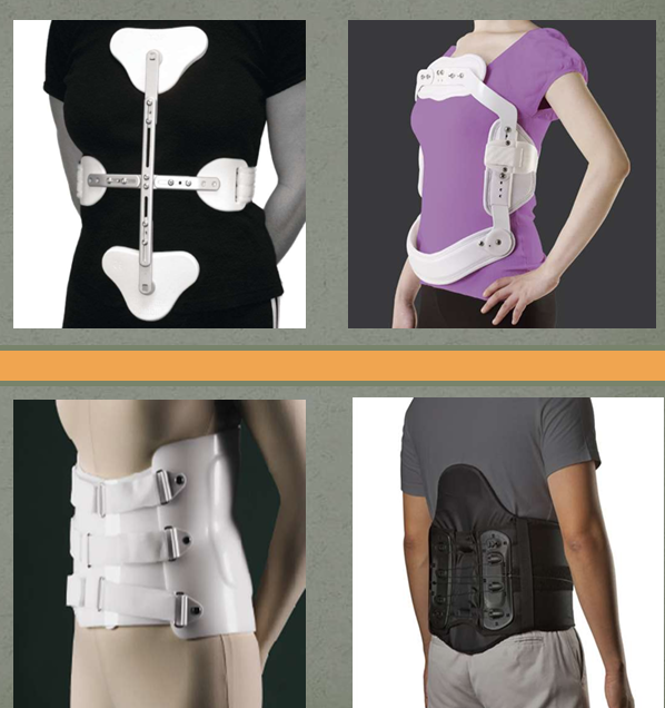 <ul><li><p>CASH or Jewett Brace for thoracic compression fractures</p></li><li><p>Lumbosacral Orthosis (LSO) for lumbar compression fractures</p></li></ul><p></p>