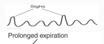 <p>Breathing punctuated by frequent sighs - suggests hyperventilation syndrome—a common cause of dyspnea and dizziness. Occasional sighs are normal</p>