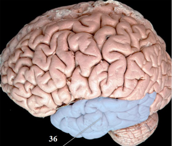 <p>Name this lobe</p>