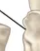<p>Indentation</p>