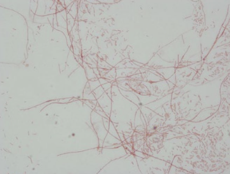 <ul><li><p>Gram -</p></li><li><p>Rod</p></li><li><p>Filamentous</p></li><li><p>Anaerobic, but aerotolerant</p></li><li><p>Non-spore forming</p></li></ul><p></p>