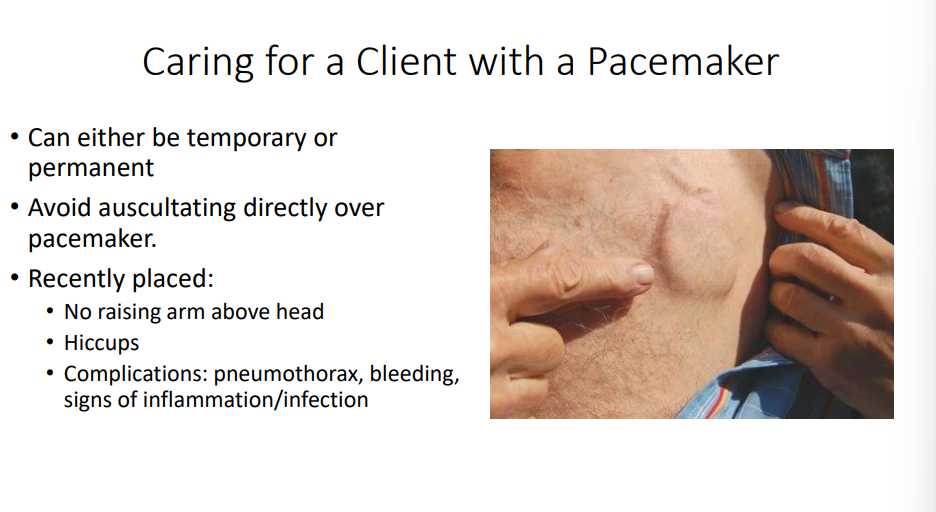 <p>If a pacemaker is recently placed in a client, what are the restrictions for the patient?</p>