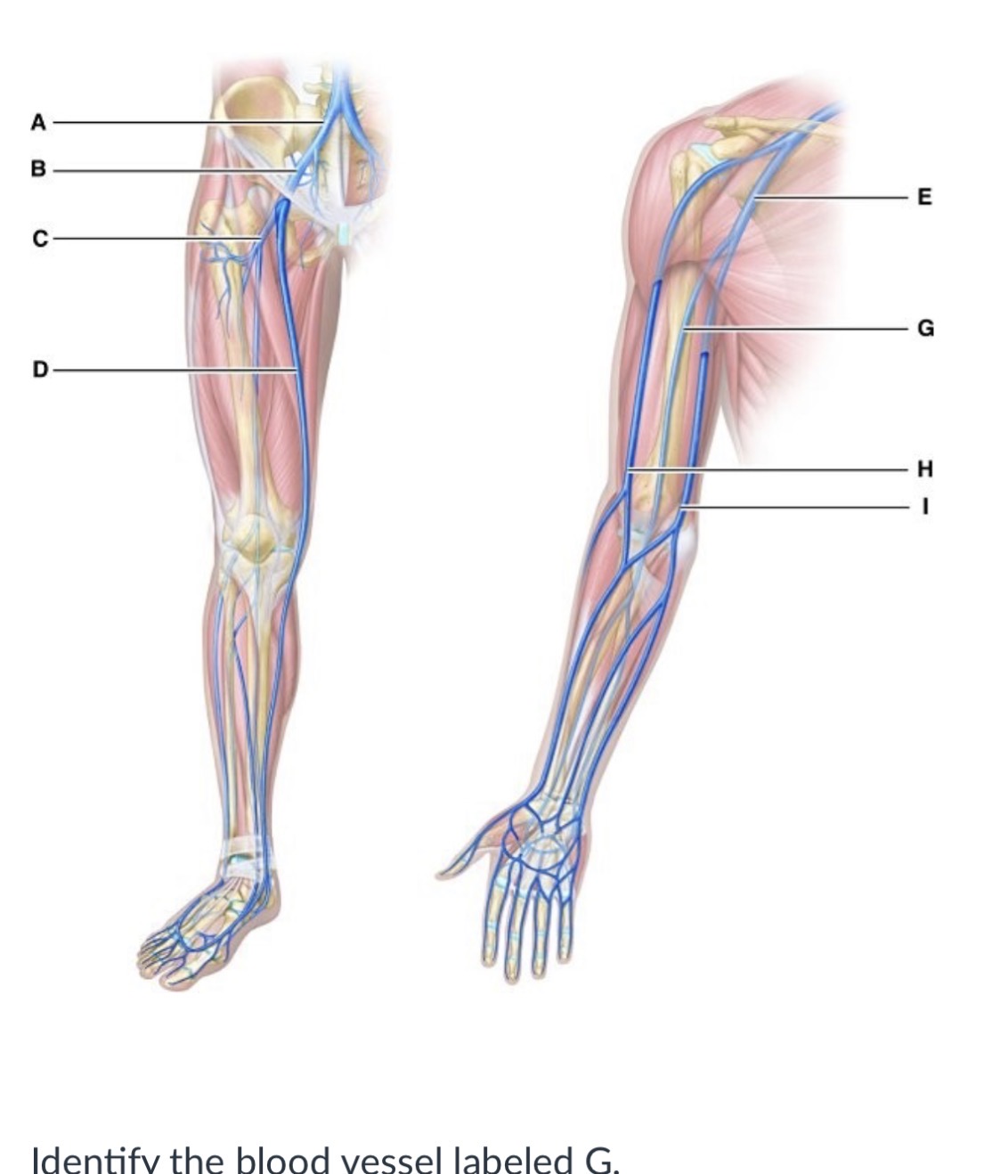 <p>Radial vein</p><p>Cephalic vein</p><p>Axillary vein</p><p>Brachial vein</p>