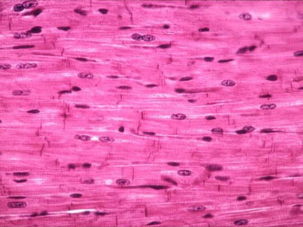 <p>Distinguish the muscle tissue:</p>