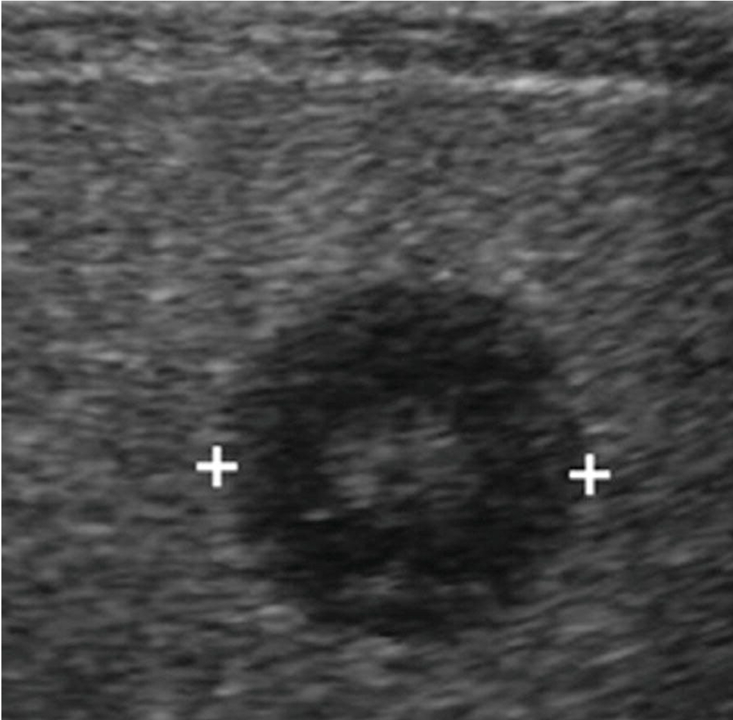 term image