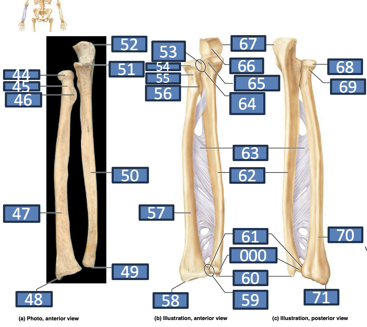 <p>58</p>
