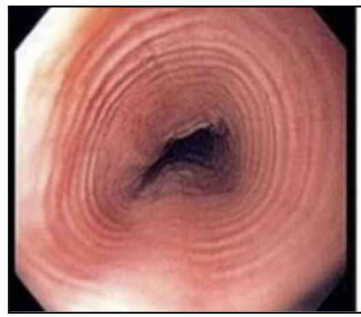 <p>diagnosis, feline esophagus</p>