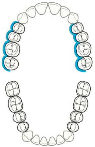 <p><strong>Upcoming flashcards practice for finger rest (</strong><span style="color: rgb(255, 0, 0);"><strong>Maxillary posterior, away</strong></span><strong>)</strong></p>