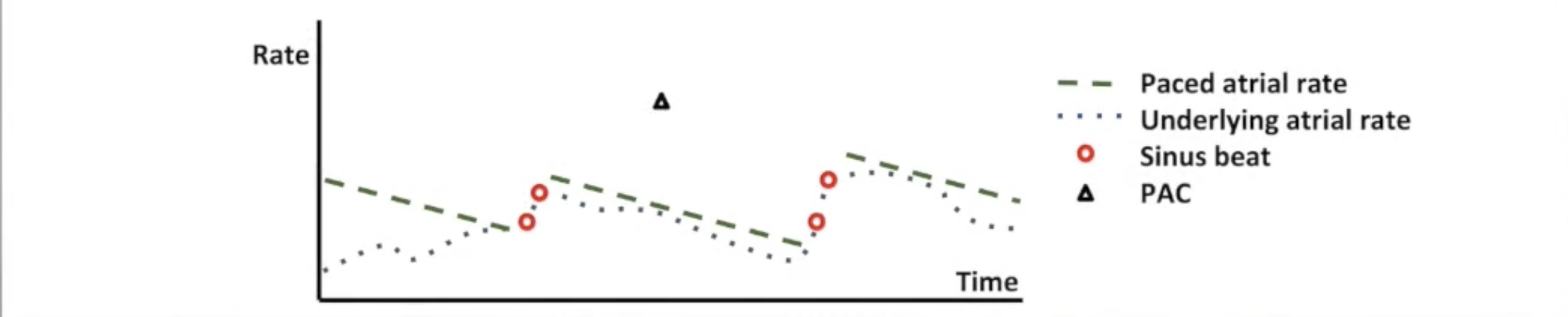 <ul><li><p>Adjusts atrial pacing rate above intrinsic rhythm</p></li><li><p>Pace ~95% of time</p></li><li><p>Keep atria refractory to suppress AF triggers</p></li><li><p>Sinus beats detected (usually 2+): raise pacing rate</p></li><li><p>Programmable maximum rate (seperate from MSR)</p></li><li><p>Rate slowly decreases towards base rate</p></li></ul><p></p>