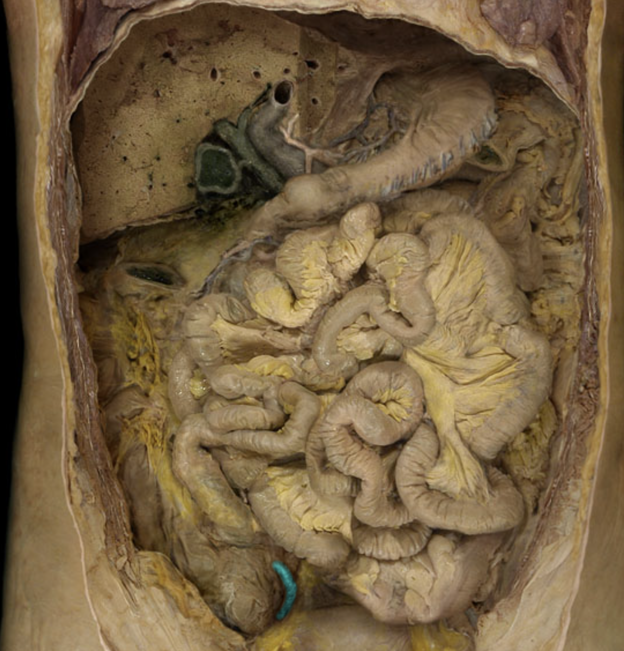 term image
