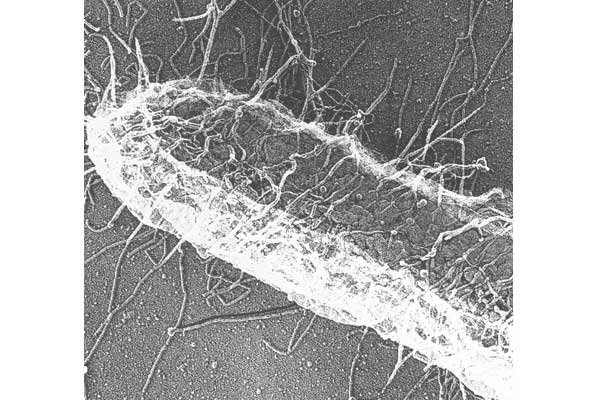 <p>Hair-like appendages that consist of proteins</p><p>Help bacteria stick to each other and fasten bacteria to the membranes of the host</p>