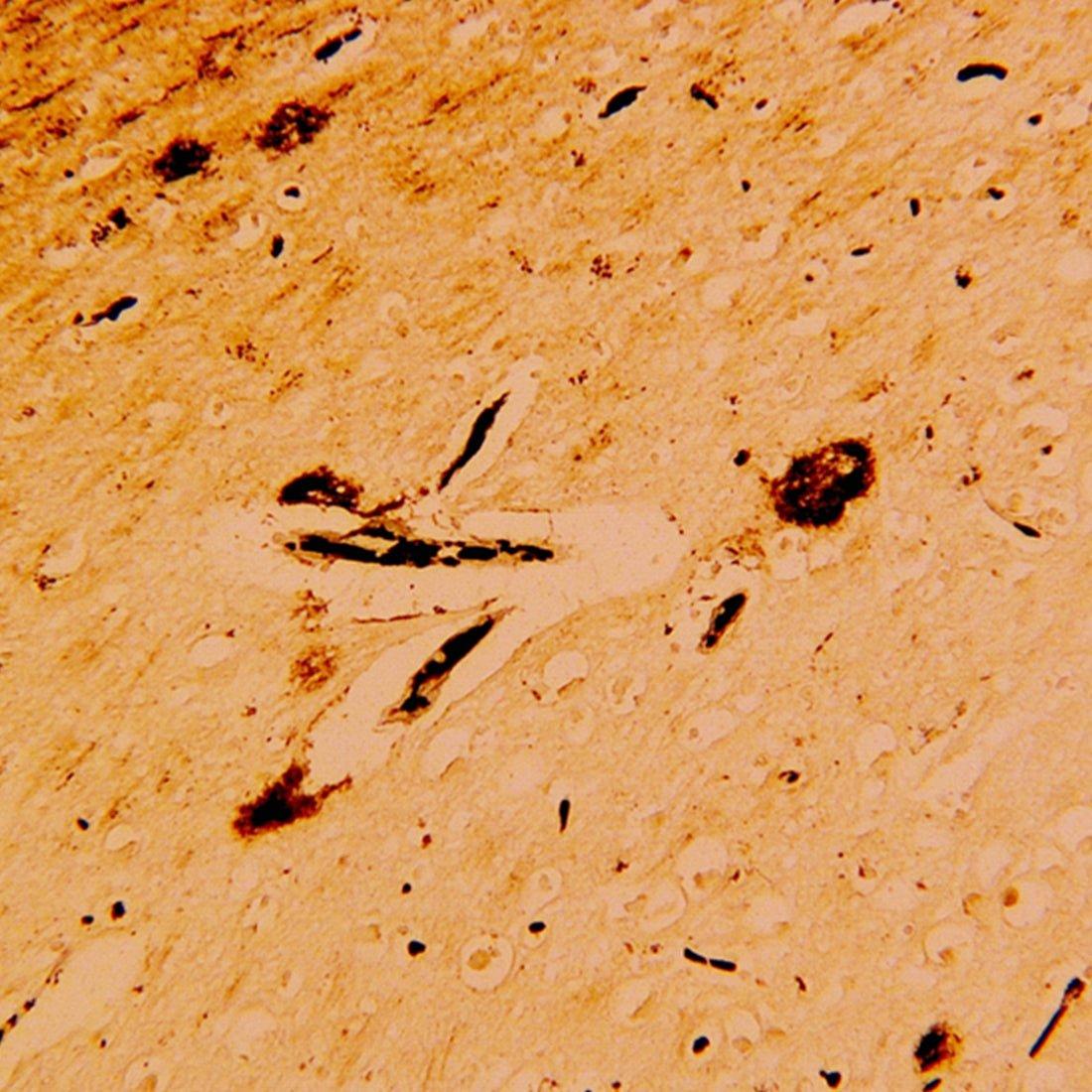 <p><em>Polysciences, Inc. (n.d.). Bielschowsky-stained brain tissue [Photomicrograph].</em></p>