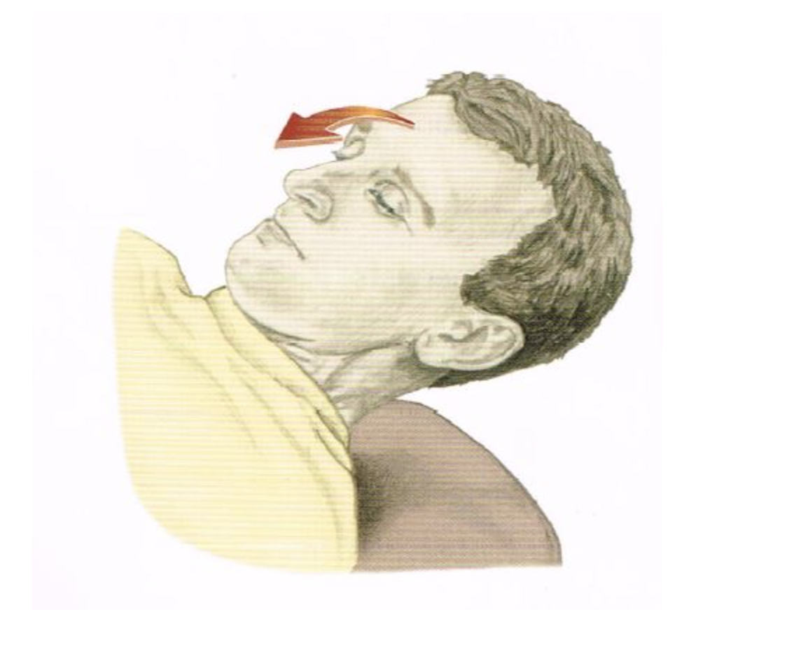 <p>Categorize the listed muscles as either agonists/synergists OR antagonists for the motion pictured below. NOTE: Some muscles will not be classified. NO partial credit.</p>