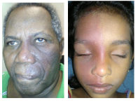 <p>What is the most likely diagnosis ?</p>