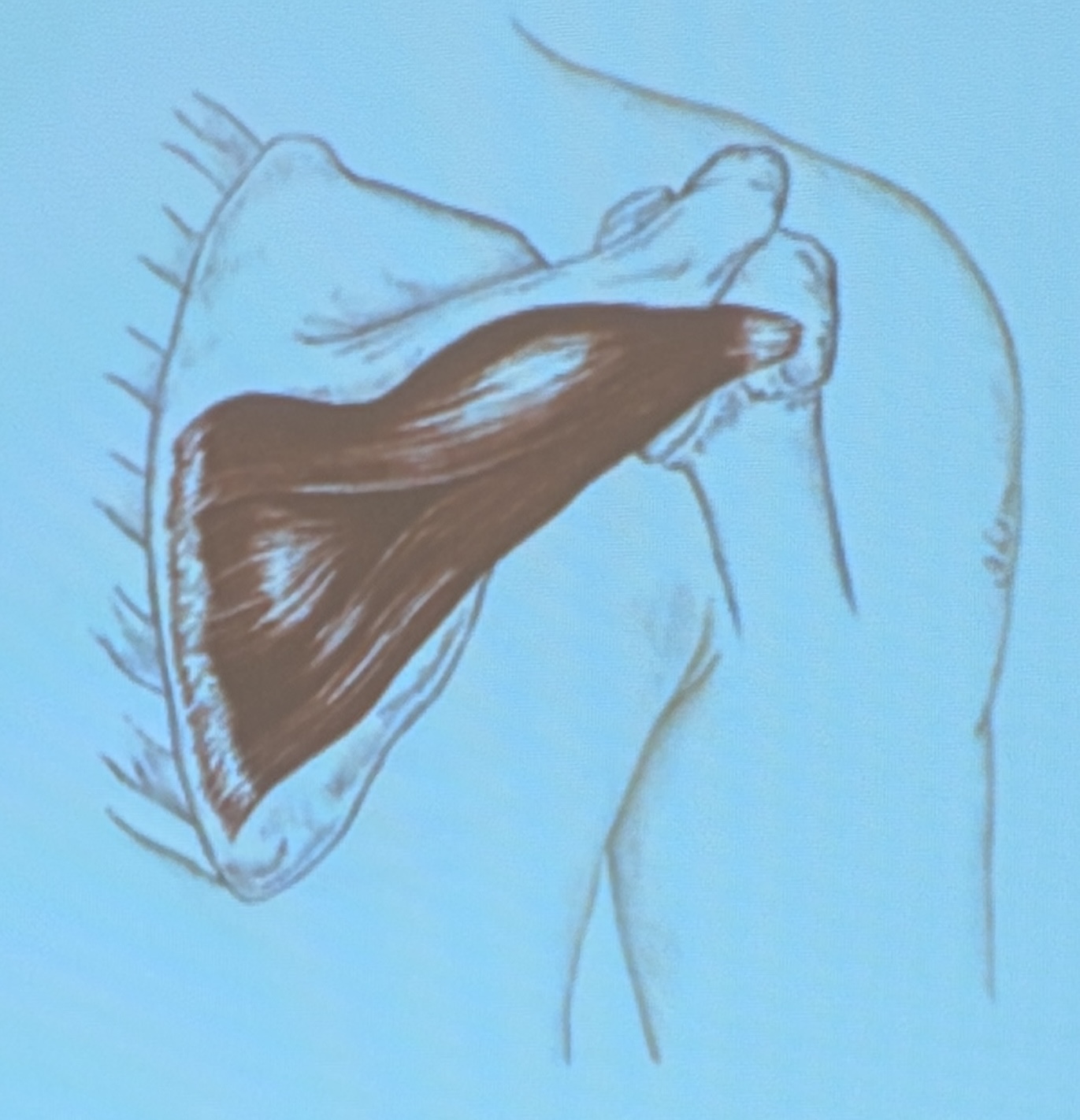 <p>Muscle name?</p>