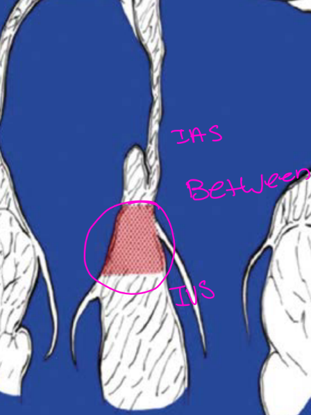 <p>An atrioventricular septal defect is characterized by a <strong>deficiency in the AV septum</strong> with abnormalities of the inflow valves.</p><ol><li><p>AVSD</p></li><li><p>Atrioventricular defect</p></li><li><p>AV canal defect</p></li><li><p>Endocardial cushion defect</p></li></ol><p>(AV septal defects are between the IAS and Ventricular septum, its still more of the muscular portion of the ventricular septum will be in the inlet area and also the primum area of the Atrial spetum b/c of the location it causes inflow anomalies) </p><p>The pic shows the nob of tissue / button of the AVSD</p>