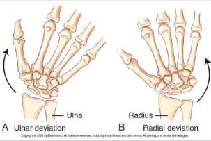 <p>ulnar = turn/bend hand + wrist from natural position toward ulnar side (towards pinky side)</p><p>radial = turn/bend hand + wrist toward radial side (towards thumb side)</p>
