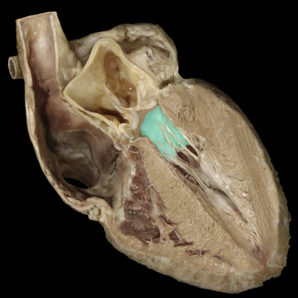 <p>Identify the feature of the left atrium</p>