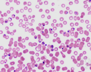 <p>PATHOGENIC PROTISTS:</p>