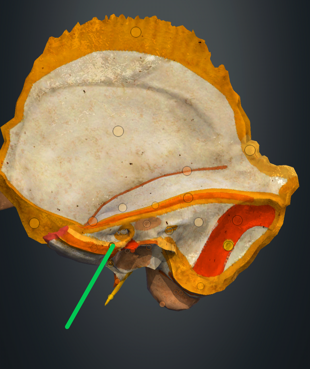 <p>margo posterior partis petrosae</p>
