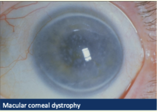 <p>Describe and give diagnosis </p>