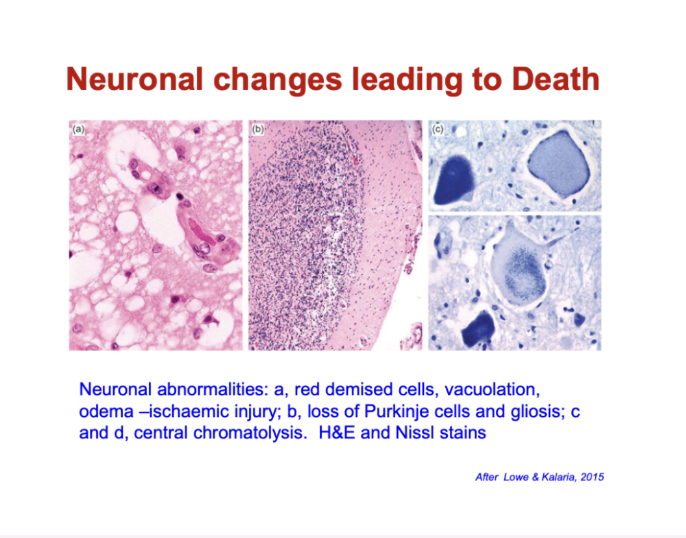<ul><li><p><strong>Early injury (e.g. ischaemia):</strong></p><ul><li><p><strong>“Red neurons”</strong> (shrunken, intensely stained)</p></li><li><p><strong>Vacuolation &amp; oedema</strong> (cell swelling/damage)</p></li></ul></li><li><p><strong>Progression:</strong></p><ul><li><p><strong>Loss of neurons</strong> (e.g. Purkinje cells)</p></li><li><p><strong>Gliosis</strong> (increase in supporting glial cells after injury)</p></li></ul></li><li><p><strong>Cellular breakdown:</strong></p><ul><li><p><strong>Chromatolysis</strong> (loss/disruption of Nissl substance → impaired protein synthesis)</p></li></ul></li></ul><p></p>