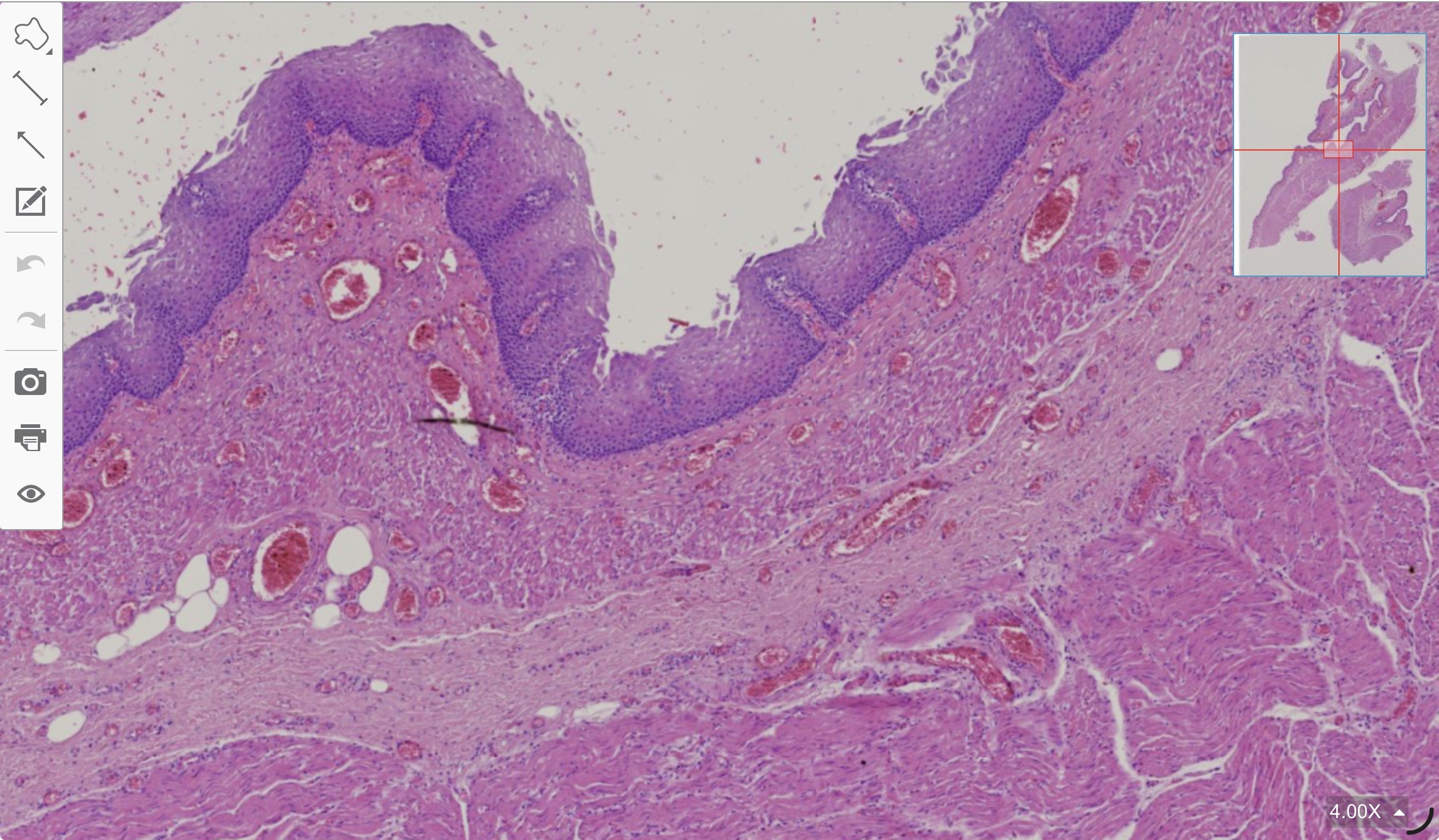 term image
