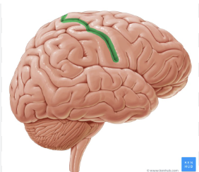 <p>Name this sulcus of the brain</p>
