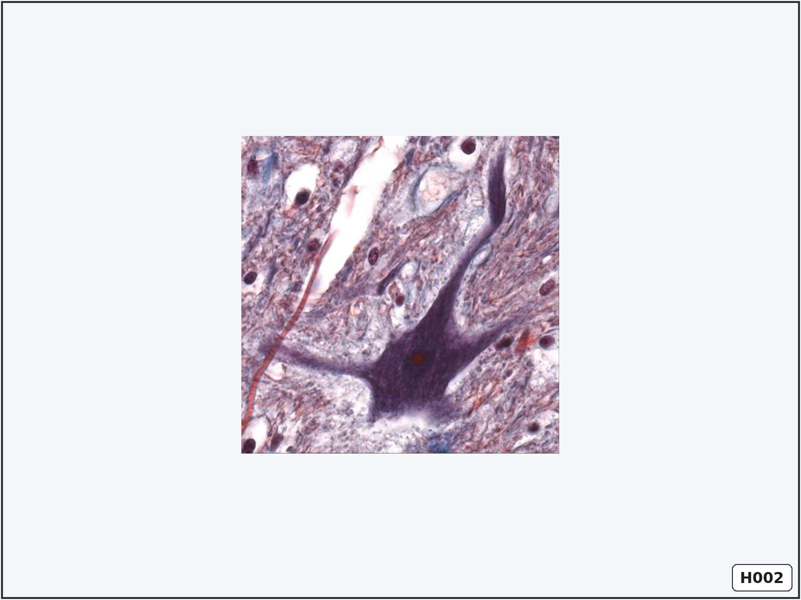 term image