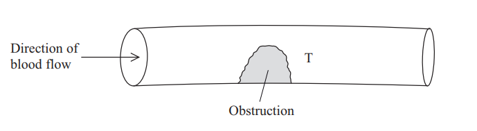 <p>add flow lines to indicate laminar and turbulent flow</p>