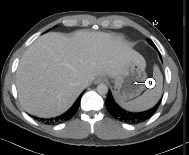 <p>Please label 9</p>