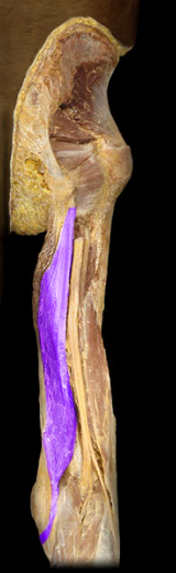 <p>knee flexion, hip extension</p>