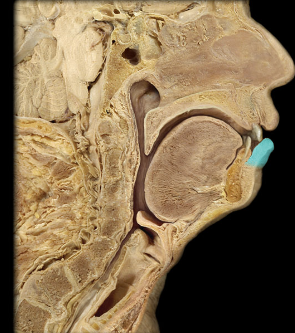 term image