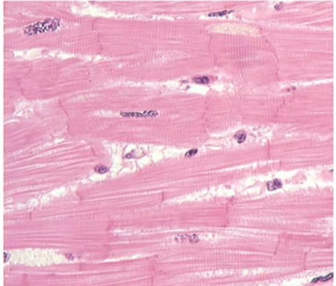 <p>located only in the heart, striated, branched cells with 1-3 central nuclei, connected via intercalated discs, involuntary control</p>