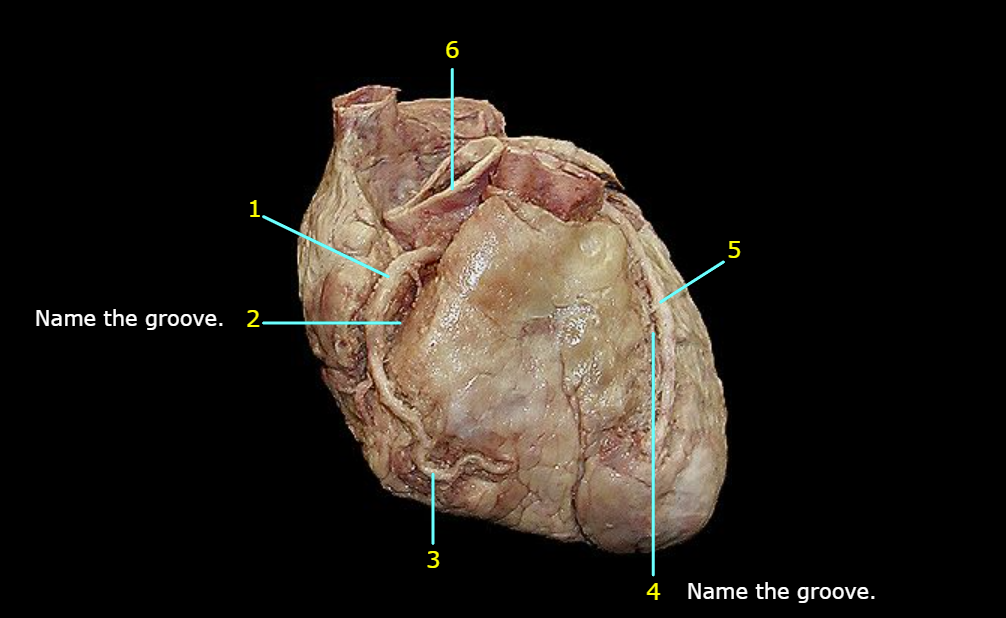 <p>What is 1 pointing to?</p>