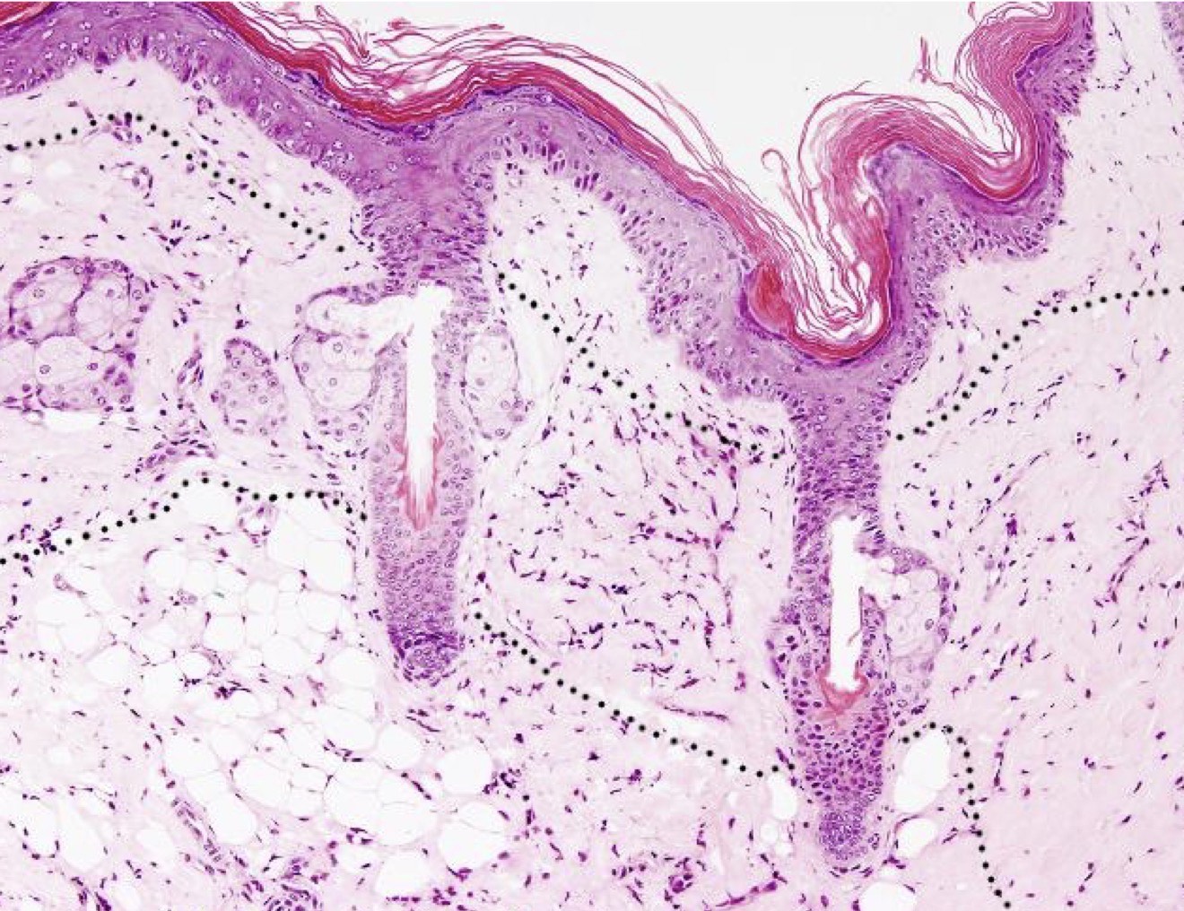 <p>Identify the layer?</p>
