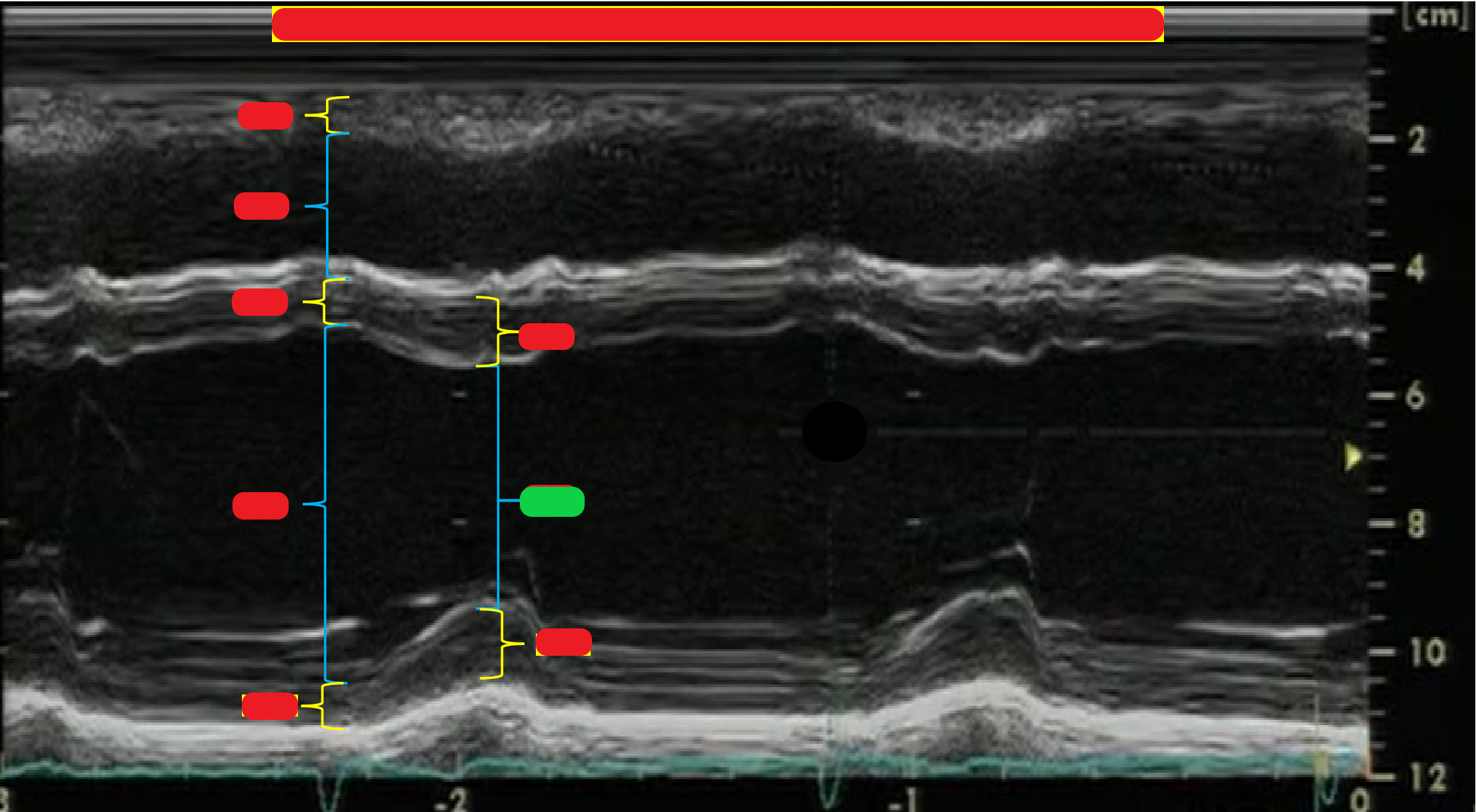 <p>What is highlighted in green?</p>